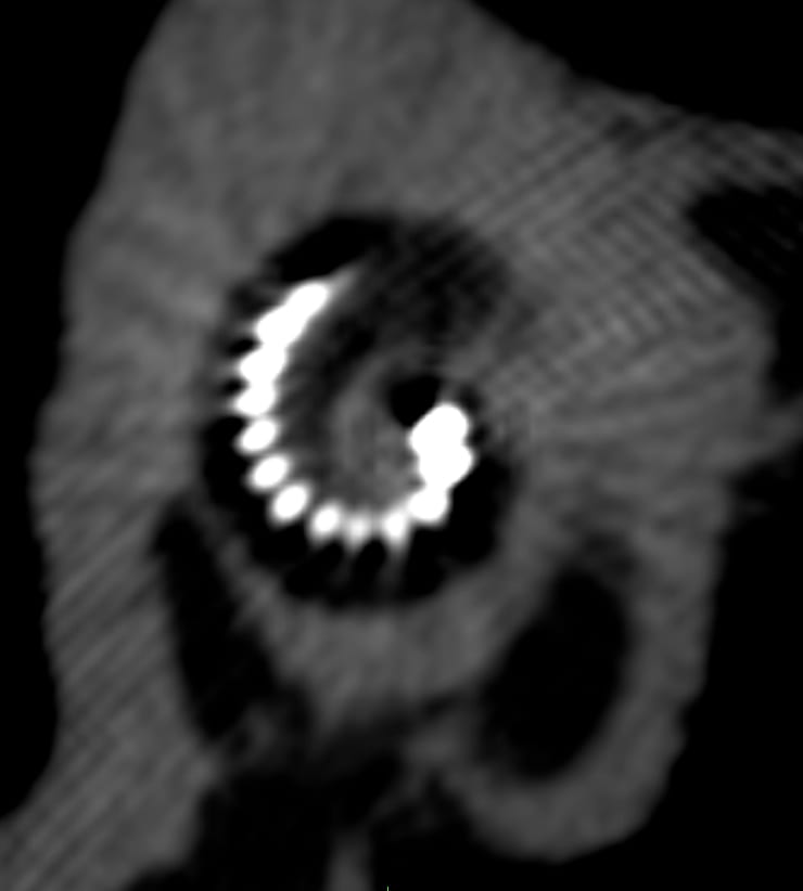 Hearing & Implants 2025